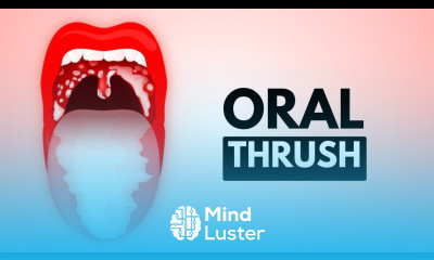 Cracking the Thrush Code Discovering Why It Keeps Coming Back