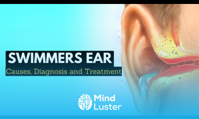 Say Goodbye to Swimmer s Ear Effective Treatment Options