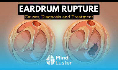 The Science Behind Eardrum Rupture Explained in Simple Terms
