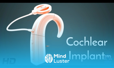 Cochlear Implants Enhancing Communication and Quality of Life