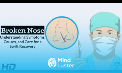 Broken Nose Understanding Symptoms Causes and Cures 1080p 231026