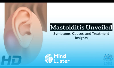 Mastoiditis The Hidden Danger Behind Ear Infections