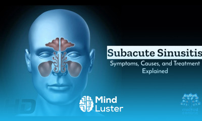 Subacute Sinusitis Causes and Remedies