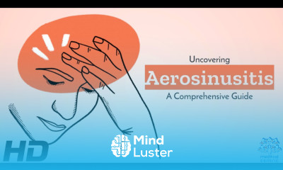Aerosinusitis Sinus Pain in the Skies