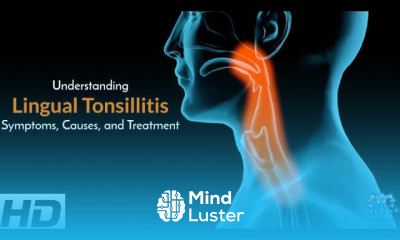 Lingual Tonsillitis A Comprehensive Guide