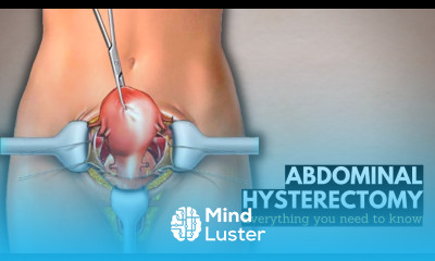 Abdominal Hysterectomy Everything You Need to Know