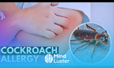 Cockroach Allergy Unmasked Symptoms Diagnosis and Treatment