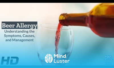 Beer Allergy Explained Symptoms Triggers Treatment Options