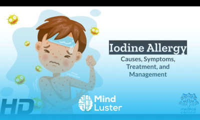 Iodine Allergy Unveiled Causes Symptoms and Solutions