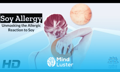 Beyond Tofu Understanding the Soy Allergy Spectrum