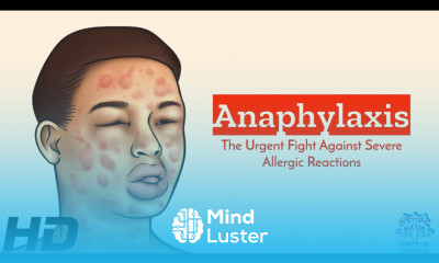 Anaphylaxis SOS A Comprehensive Guide to Recognizing and Reacting