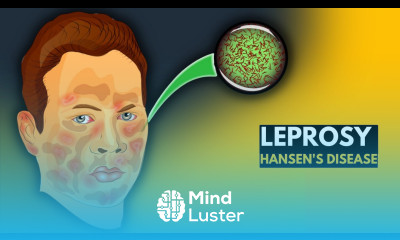 Leprosy Hansen s disease Everything You Need to Know