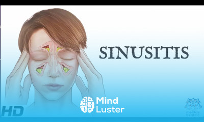 Sinusitis Everything You Need To Know