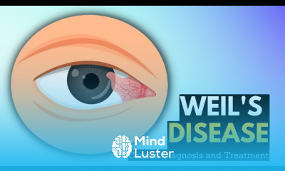 Weil s Disease Causes Symptoms And Treatment