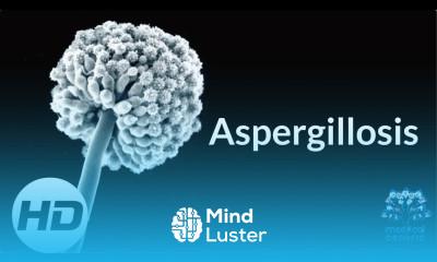 Aspergillosis Everything You Need To Know