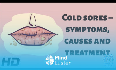 Cold Sores – Symptoms Causes and Treatment