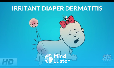 Irritant Diaper Dermatitis Causes Signs and Symptoms Diagnosis and Treatment
