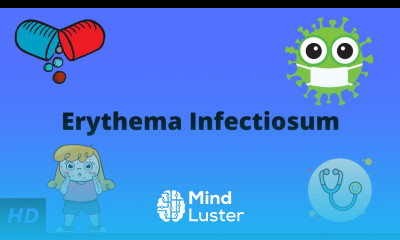 Erythema Infectiosum Causes Signs and Symptoms Diagnosis and Treatment