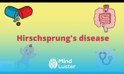 Hirschsprung s Disease Causes Signs and Symptoms Diagnosis and Treatment