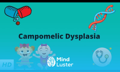Campomelic Dysplasia Causes Signs and Symptoms Diagnosis and Treatment