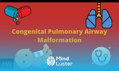 Congenital Pulmonary Airway Malformation Causes Signs and Symptoms Diagnosis and Treatment