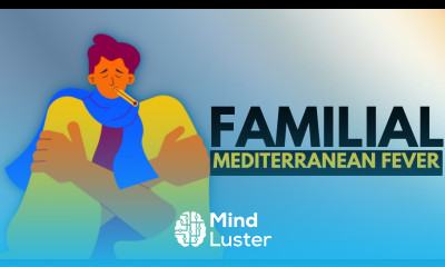 Familial Mediterranean Fever Causes Symptoms Treatment And More