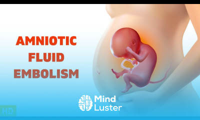 Amniotic Fluid Embolism The Silent Threat During Childbirth