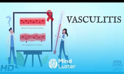 Vasculitis Everything You Need To Know