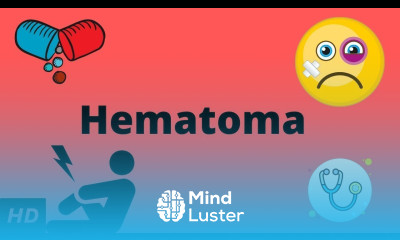 Hematoma Causes Signs and Symptoms Diagnosis and Treatment