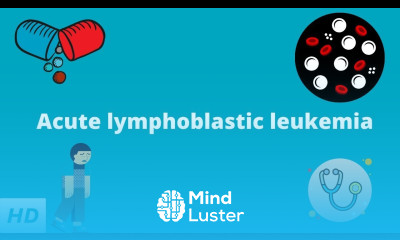 Acute Lymphoblastic Leukemia Causes Signs and Symptoms Diagnosis and Treatment