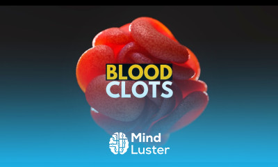 Blood Clots Causes Signs and Symtpoms Diagnosis and Treatment