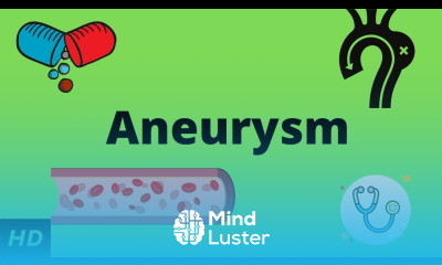 Aneurysm Causes Signs and Symptoms Diagnosis and Treatment