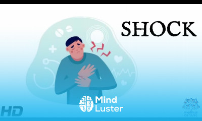 Shock Everything You Need To Know