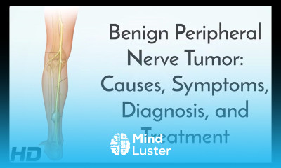 Benign Peripheral Nerve Tumor Causes Symptoms Diagnosis and Treatment