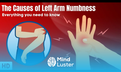 The Causes Of Left Arm Numbness
