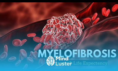 Myelofibrosis Explained What You Need to Know