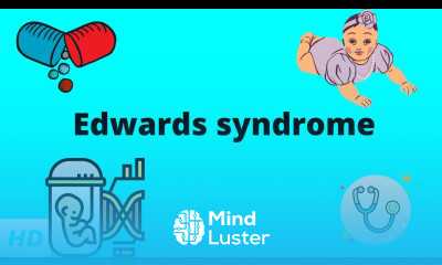 Edwards Syndrome Causes Signs and Symptoms Diagnosis and Treatment