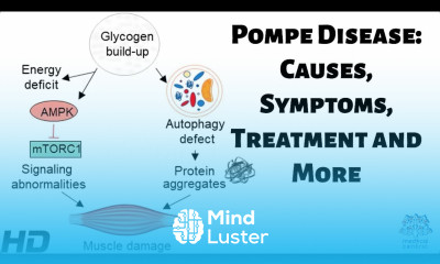 Pompe Disease Causes Symptoms Treatment and More