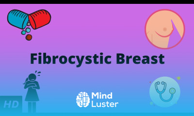 Fibrocystic Breast Causes Signs and Symptoms Diagnosis and Treatment