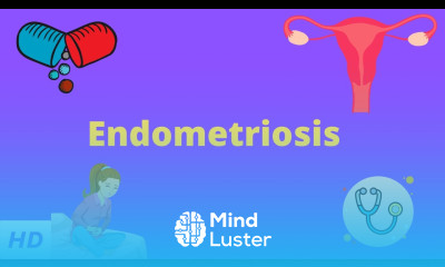 Endometriosis Causes Signs and Symptoms Diagnosis and Treatment