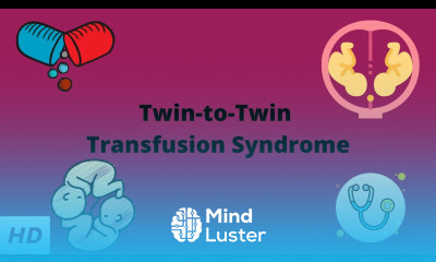 Twin to Twin Transfusion Syndrome