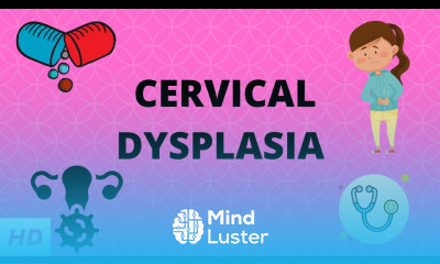 Cervical Dysplasia Causes Signs and Symptoms Diagnosis and Treatment