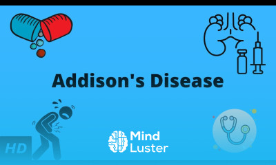 Addison s Disease Causes Signs and Symptoms Diagnosis and Treatment