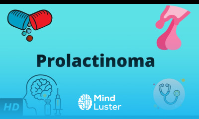 Prolactinoma Causes Signs and Symptoms Diagnosis and Treatment