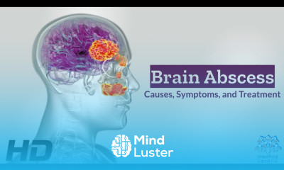 Brain Abscess Unveiled Causes Symptoms and Lifesaving Treatments