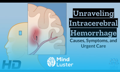 Intracerebral Hemorrhage Unveiled Understanding the Whys Whats and Hows