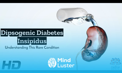 Dipsogenic Diabetes The Endless Thirst