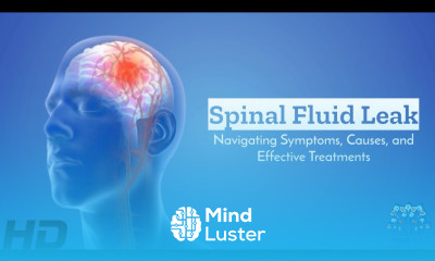 Spinal Fluid Leak SOS Identifying Treating and Preventing