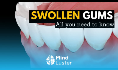 Swollen Gums Explained What You Need to Know and How to Treat Them