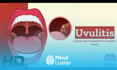 Uvulitis Explained What s Causing Your Swollen Uvula